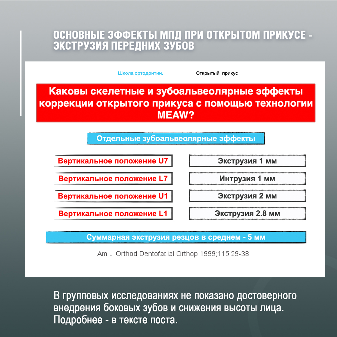 Мифы многопетлевой техники – МПД, MEAW. Часть 1. - интересно об ортодонтии,  имплантации и протезировании зубов